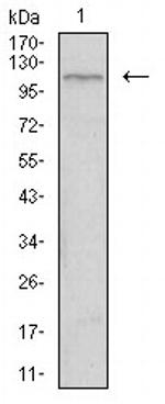 TIE1 Antibody in Western Blot (WB)