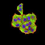 Human Parvovirus VP2 Monoclonal Antibody (4E5A4)