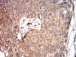 Human Parvovirus VP2 Antibody in Immunohistochemistry (Paraffin) (IHC (P))