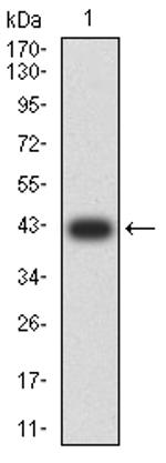 Human Parvovirus VP2 Antibody in Western Blot (WB)