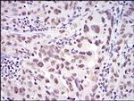 Ku70 Antibody in Immunohistochemistry (Paraffin) (IHC (P))
