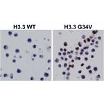 H3.3 G34V oncohistone mutant Recombinant Rabbit Monoclonal Antibody (RM307), ChIP-Verified