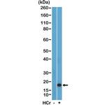 H3K27cr Recombinant Rabbit Monoclonal Antibody (RM401)