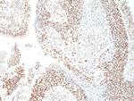 HDAC3 Recombinant Rabbit Monoclonal Antibody (RM439)