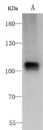 ACE2 Recombinant Rabbit Monoclonal Antibody (003)