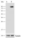 ALPL Recombinant Rabbit Monoclonal Antibody (077)