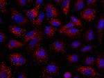 Angiopoietin 2 Antibody in Immunocytochemistry (ICC/IF)