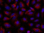 Angiopoietin 2 Recombinant Rabbit Monoclonal Antibody (117)