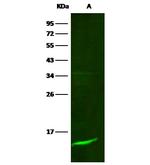 beta-2 Microglobulin Recombinant Rabbit Monoclonal Antibody (201)