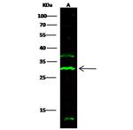 CD244 Recombinant Rabbit Monoclonal Antibody (025)