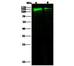 E-cadherin Recombinant Rabbit Monoclonal Antibody (056)