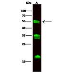 Carboxypeptidase M Recombinant Rabbit Monoclonal Antibody (105)