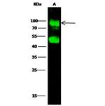 GNS Recombinant Rabbit Monoclonal Antibody (007)