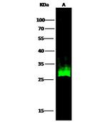 HSP27 Recombinant Rabbit Monoclonal Antibody (017)
