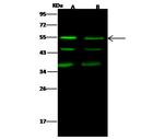 JNK2 Recombinant Rabbit Monoclonal Antibody (004)