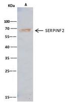 SERPINF2 Antibody in Immunoprecipitation (IP)