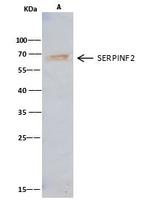 SERPINF2 Antibody in Immunoprecipitation (IP)