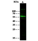 SERPINF2 Recombinant Rabbit Monoclonal Antibody (001)