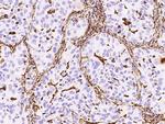 Vimentin Antibody in Immunohistochemistry (Paraffin) (IHC (P))