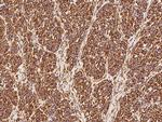 Vimentin Antibody in Immunohistochemistry (Paraffin) (IHC (P))