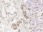 Vimentin Antibody in Immunohistochemistry (Paraffin) (IHC (P))