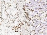Vimentin Antibody in Immunohistochemistry (Paraffin) (IHC (P))