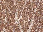 Vimentin Antibody in Immunohistochemistry (Paraffin) (IHC (P))