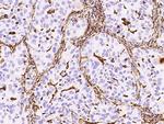 Vimentin Antibody in Immunohistochemistry (Paraffin) (IHC (P))