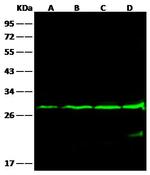 Bcl-2 Monoclonal Antibody (09)