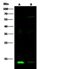 Human Galectin-1 Monoclonal Antibody (02)