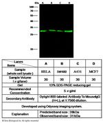 Galectin 3 Monoclonal Antibody (01)