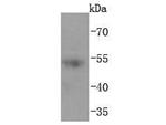 Acetyl-p53 (Lys382) Antibody in Western Blot (WB)