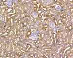 VDAC Recombinant Rabbit Monoclonal Antibody (SA93-03)