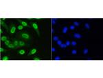 H3K36me1 Recombinant Rabbit Monoclonal Antibody (SR04-20)