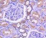 MEK1 Antibody in Immunohistochemistry (Paraffin) (IHC (P))