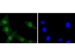ERK1 Recombinant Rabbit Monoclonal Antibody (SP00-74)