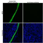 Cytokeratin 5 Antibody in Immunohistochemistry (Paraffin) (IHC (P))