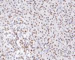 HDAC1 Recombinant Rabbit Monoclonal Antibody (SY12-04)