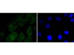 MSI1 Recombinant Rabbit Monoclonal Antibody (SJ201)