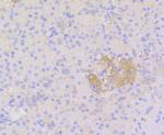 STAT3 Antibody in Immunohistochemistry (Paraffin) (IHC (P))