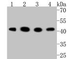 GSK3B Antibody in Western Blot (WB)