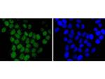 H2BR79me1 Recombinant Rabbit Monoclonal Antibody (ST0430)