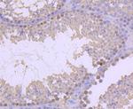 H2BR79me1 Antibody in Immunohistochemistry (Paraffin) (IHC (P))