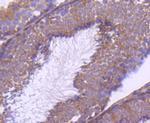 mTOR Antibody in Immunohistochemistry (Paraffin) (IHC (P))