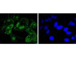 PARP1 Recombinant Rabbit Monoclonal Antibody (SU03-68)