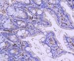 PARP1 Antibody in Immunohistochemistry (Paraffin) (IHC (P))