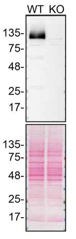 PARP1 Antibody in Western Blot (WB)