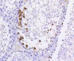 Phospho-Histone H3 (Ser10) Antibody in Immunohistochemistry (Paraffin) (IHC (P))