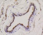 Stathmin 1 Recombinant Rabbit Monoclonal Antibody (SS0453)