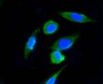 Ubiquitin Recombinant Rabbit Monoclonal Antibody (ST46-03)